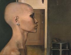 Postoperatorio - Oscar Tusquets Blanca